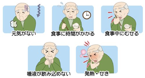 誤嚥性肺炎の症状