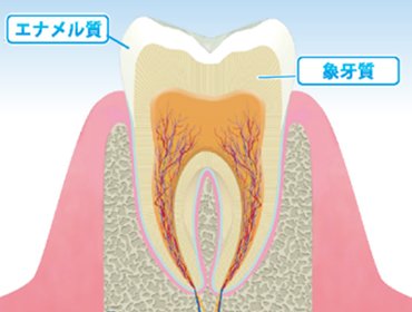 エナメル質